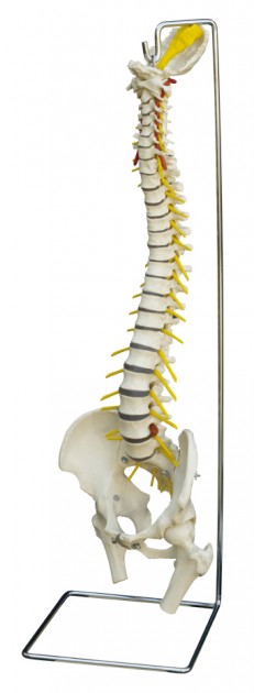 Human spine with herniated disc 